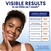 Skin Success Body & Face Care Anti-Dark Spot Extra Strength Tone Correcting Cream